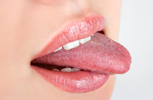 what does a healthy tongue look like