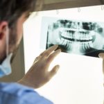 dental x-rays